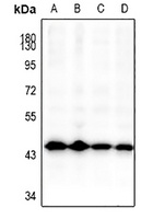 GSK3 beta Rabbit Polyclonal Antibody