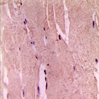 GYS1 (Phospho-S645) Antibody