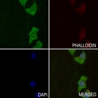 GYS1 (Phospho-S645) Antibody