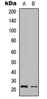 Granzyme H Rabbit Polyclonal Antibody