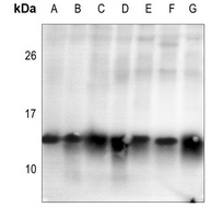 Histone H2B (Acetyl-K15) Rabbit Polyclonal Antibody