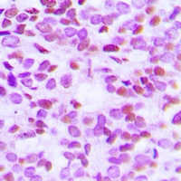 Histone H2B (Acetyl-K15) Rabbit Polyclonal Antibody