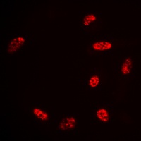 Histone H2B (Acetyl-K15) Rabbit Polyclonal Antibody