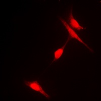Histone Deacetylase 6 (Phospho-S22) Antibody