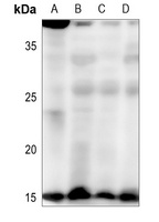 HEN1/2 Rabbit Polyclonal Antibody