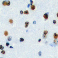 HEN1/2 Rabbit Polyclonal Antibody