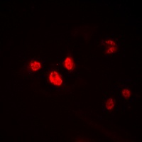 HEN1/2 Rabbit Polyclonal Antibody