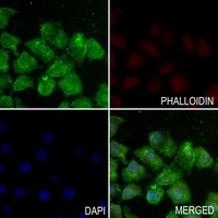 Histone H3 (Acetyl-K122) Antibody