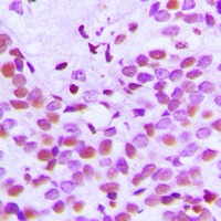 Histone H3 (Acetyl-K18) Antibody