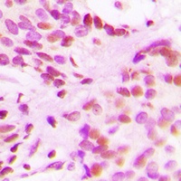Histone H3 (Acetyl-K27) Antibody