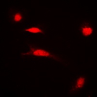 Histone H3 (Acetyl-K27) Antibody