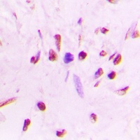 HSF1 (Phospho-S303) Antibody