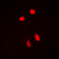 HSF1 (Phospho-S303) Antibody