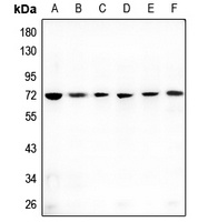 HSP70 Rabbit Polyclonal Antibody