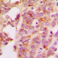 HSP70 Rabbit Polyclonal Antibody