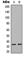 HSPBAP1 Rabbit Polyclonal Antibody