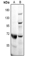 CD218b Antibody