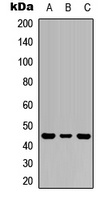 IL-1R2 Antibody