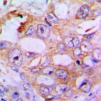 IRS1 (Phospho-S636) Antibody