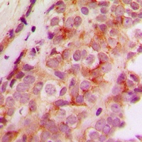 JMY Rabbit Polyclonal Antibody