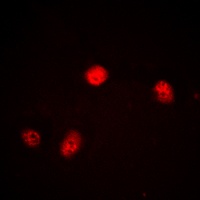 JUNB Rabbit Polyclonal Antibody