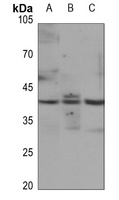 JUNB (Phospho-S259) Rabbit Polyclonal Antibody