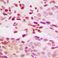 JUNB (Phospho-S259) Rabbit Polyclonal Antibody
