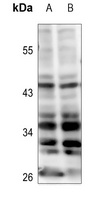 Kir6.2 Rabbit Polyclonal Antibody