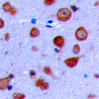 Kir6.2 Rabbit Polyclonal Antibody