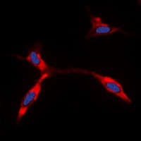 Kir6.2 Rabbit Polyclonal Antibody