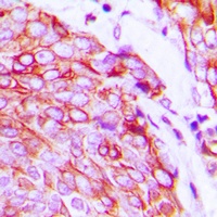VEGFR2 (Phospho-Y1175) Antibody