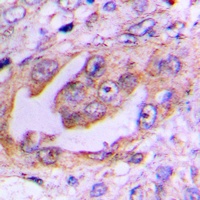 EG5 (Phospho-T926) Antibody