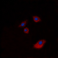 Cytokeratin 20 Antibody