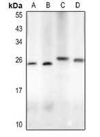 LIF Rabbit Polyclonal Antibody