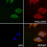 LIF Rabbit Polyclonal Antibody