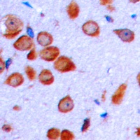LT beta Rabbit Polyclonal Antibody