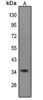 MAGEA9 Rabbit Polyclonal Antibody