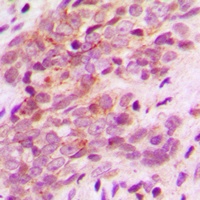 MAGEA9 Rabbit Polyclonal Antibody