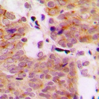 MEKK1 (Phospho-T1402) Antibody
