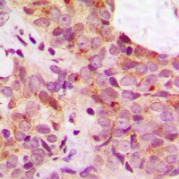 TAU (Phospho-S673) Antibody