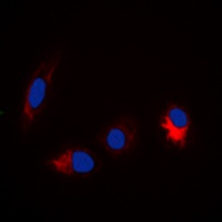 TAU (Phospho-S673) Antibody