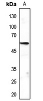 MEF2C Antibody
