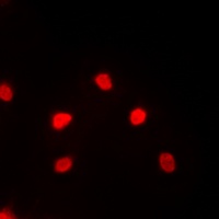 MEF2C Antibody