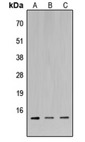MIA1 Rabbit Polyclonal Antibody