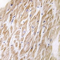 MIA1 Rabbit Polyclonal Antibody