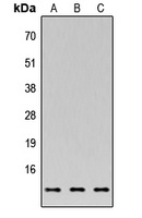 C35 Rabbit Polyclonal Antibody