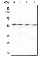 MMP10 Rabbit Polyclonal Antibody
