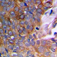 MMP10 Rabbit Polyclonal Antibody