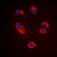 MMP10 Rabbit Polyclonal Antibody