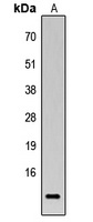 BRP44L Rabbit Polyclonal Antibody